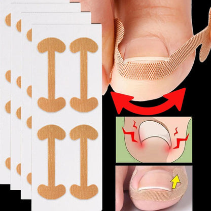 Toenail Correction Strips